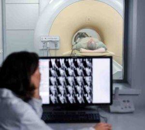 تشخيص السرطان السرطان في الأشعة السينية السرطان كيف يظهر في الأشعة